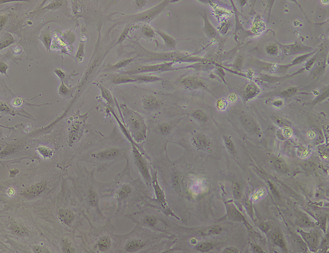 ipsc msc, induced mesenchymal stem cells, ipsc21, msc,