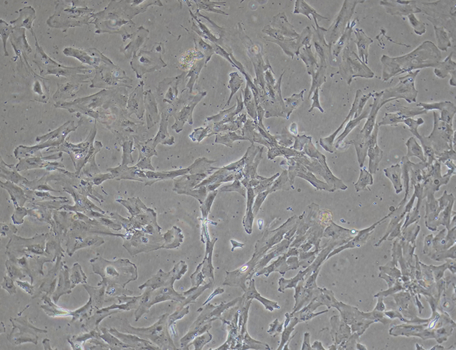 ipsc21, imsc, mesenchymal stem cells, ipsc-derived msc,