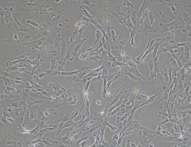 ipsc21, imsc, mesenchymal stem cells, ipsc-derived msc,