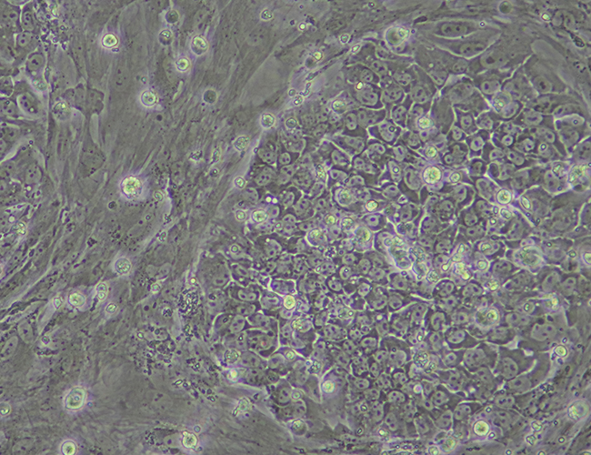 ipsc colony, pluripotent stem cells, ipscs, ipsc21,