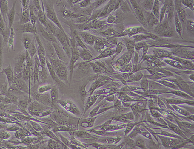 fibroblasts, ipsc21, stem cell reprogramming, pluripotent stem cell generation, mrna ipsc, ipsc generation,