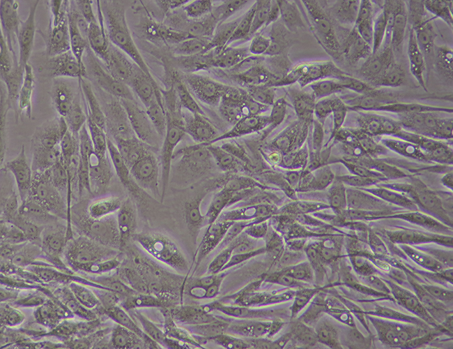 fibroblasts, ipsc21, stem cell reprogramming, pluripotent stem cell generation, mrna ipsc, ipsc generation,