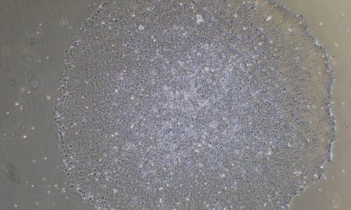 Fazeela Abbasi clonal expansion Day13 (1) (1) ipsc, induced pluripotent stem cells, ipsc banking, mrna ipsc, pluripotent stem cells, ipsc21, ipsc colony, ipsc lab, stem cell lab, stem cell culture,
